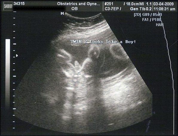Baby B - It's a Boy!